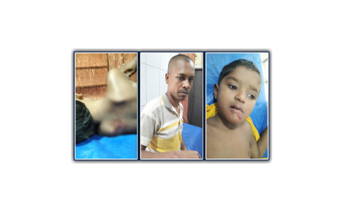 টাঙ্গাইলে কুকুরের কামড়ে শিশুসহ আহত ২২ 